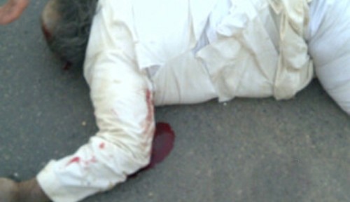 حادث كامري 2012 يوم الجمعة صباحاً بسبب التفحيط بالصور والفيديو الخبر محدث ويحتوي على اشلاء 21