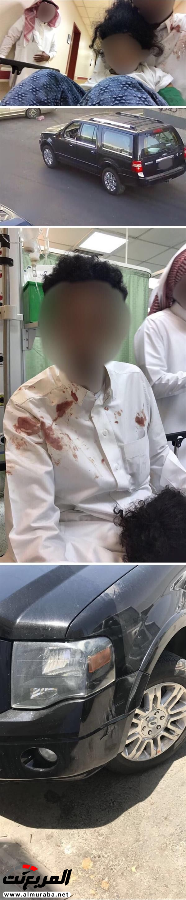 "بالصور" طفل يقود مركبة من نوع "فورد" يدهس طفلة بالطائف "بالصور" طفل يقود مركبة من نوع "فورد" يدهس طفلة بالطائف 1